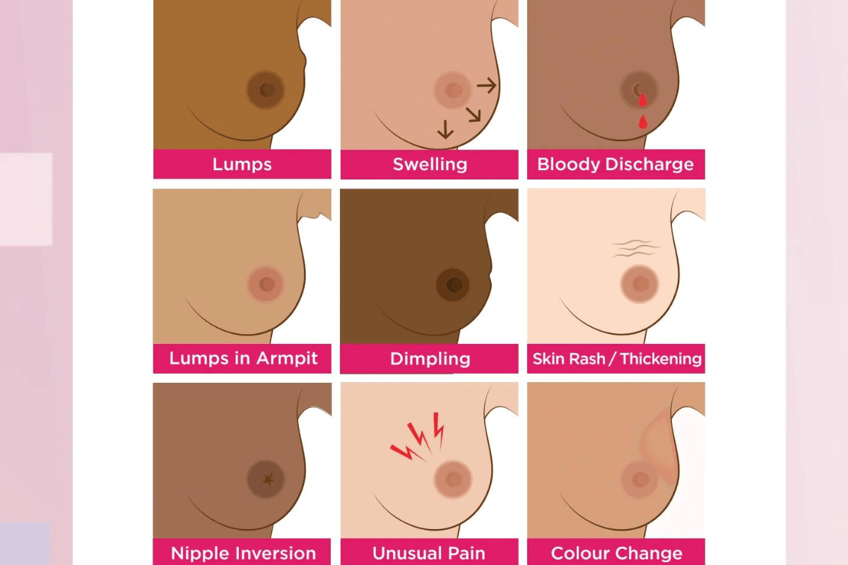 Can I have Breast Cancer and Feel Fine...? - Y.O.U underwear